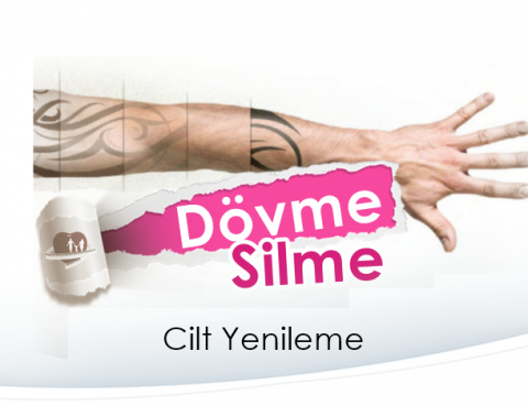 dovme silme